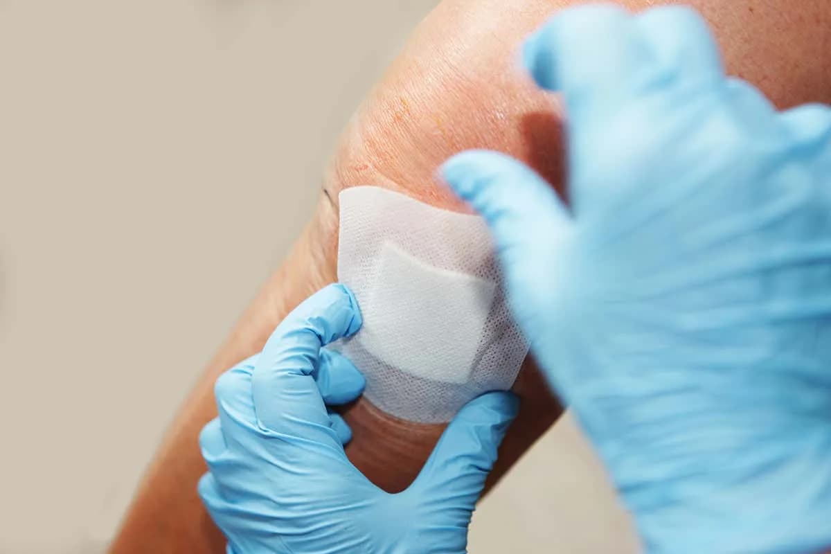 Wound Clinic in Primrose