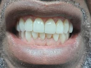Perle Dental Clinic in Ojuelegba