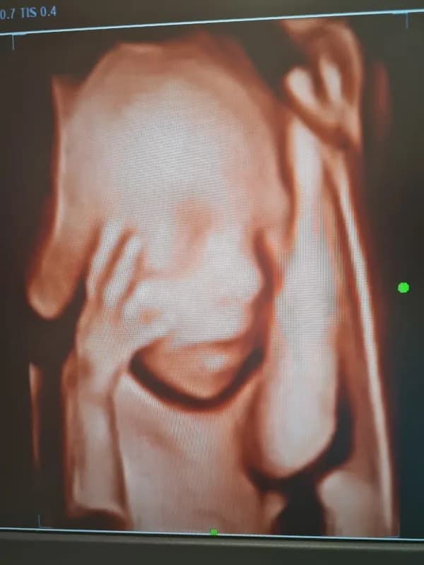 Happy Moments 4D fetal ultrasound studio in Heatherlands