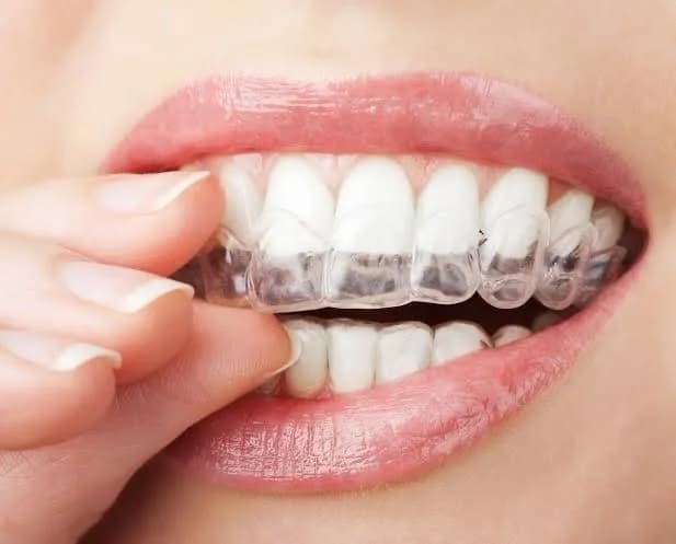 TeethMinder Dental Clinics Liasu Road in Idimu