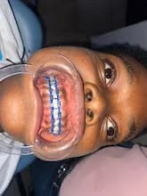 Reach Dental and Orthodontics Clinic in Aguda