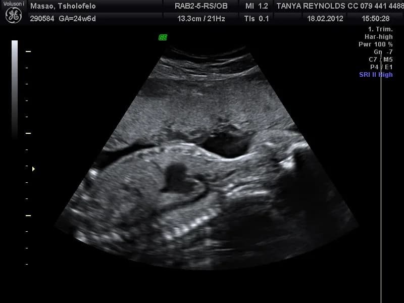 4D Ultrasound Scan in Randburg
