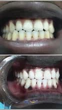 Glaze Dental & Breath Clinic in Ibeju-Lekki