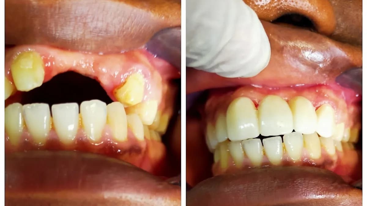 ULTIDENT DENTAL CLINIC (Lekki Ajah PAINLESS DENTIST) in Ajah