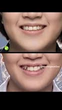 CITY DENTAL CLINIC, BRACES AND PROSTHETICS CENTRE, LAGOS NIGERIA. in Badagry