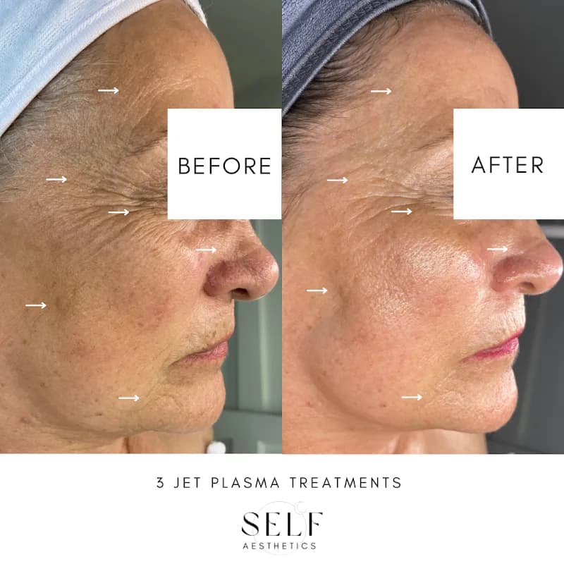 Self Aesthetics - Medical Aesthetics & Wound Healing in Techno Park