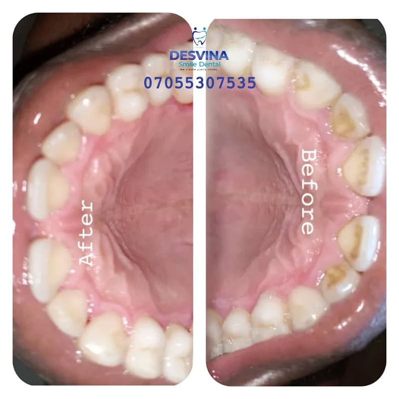 Desvina Smile Dental Clinic in Isolo