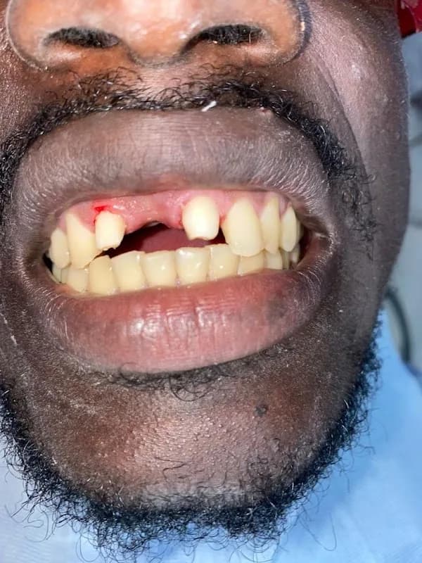 Tooth Angel Dental clinic- Ojo- ALABA ,Lagos in Mile 2