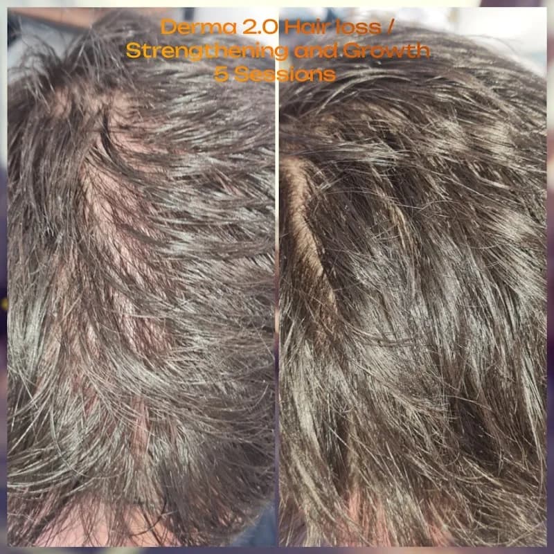 Xclusively You, Advance Skin & Laser in Benoni CBD