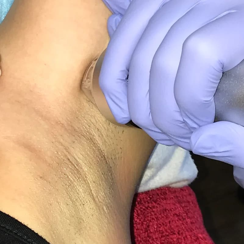 Dermatologist Johannesburg Dr Rakesh Newaj in Boksburg CBD