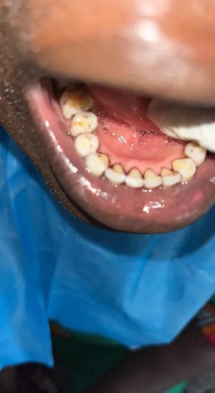 Annie's Dental Spa in Mile 2