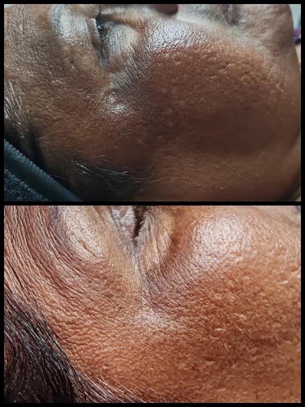 Let's Laser Aesthetic Clinic & Spa in Phoenix