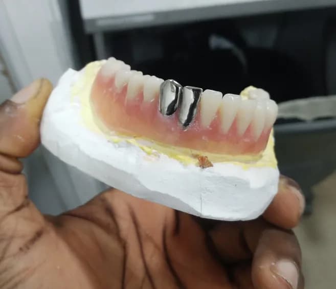 Ademilola Dental services in Abule Egba