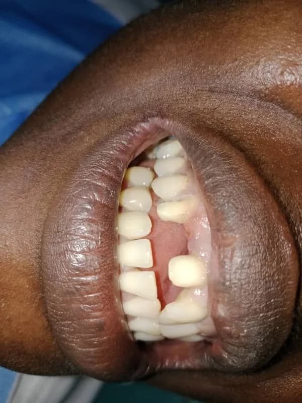 St. Modestus Mission Dental Clinic, Kirikiri Town in Kirikiri