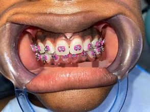 First Consultant Dental Clinic, Isolo Formerly (Care 32 Dental Clinic) in Isolo