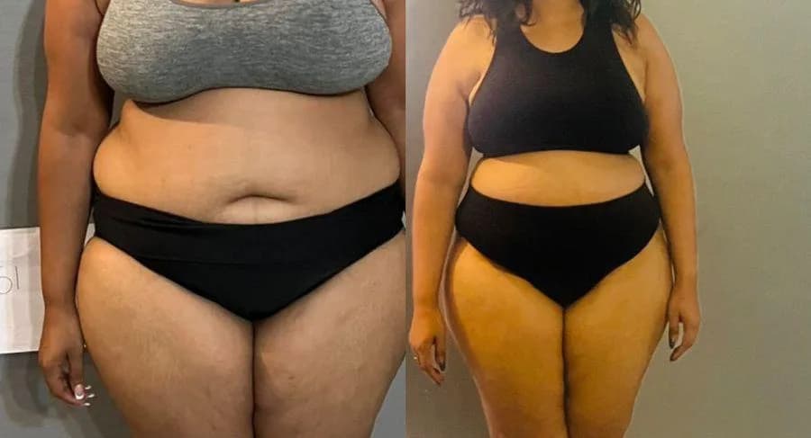 Sliq body & beauty in Willows