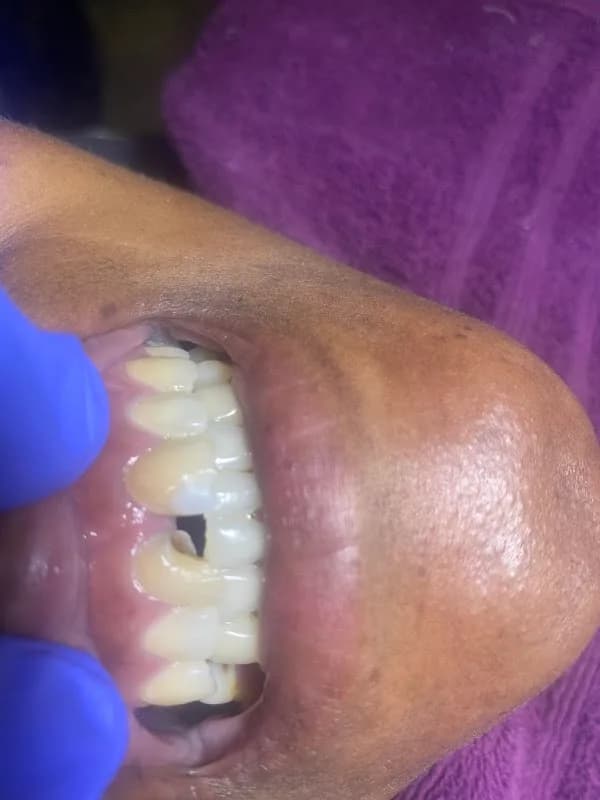 Kanyane Dental Surgery in Phuthaditjhaba CBD