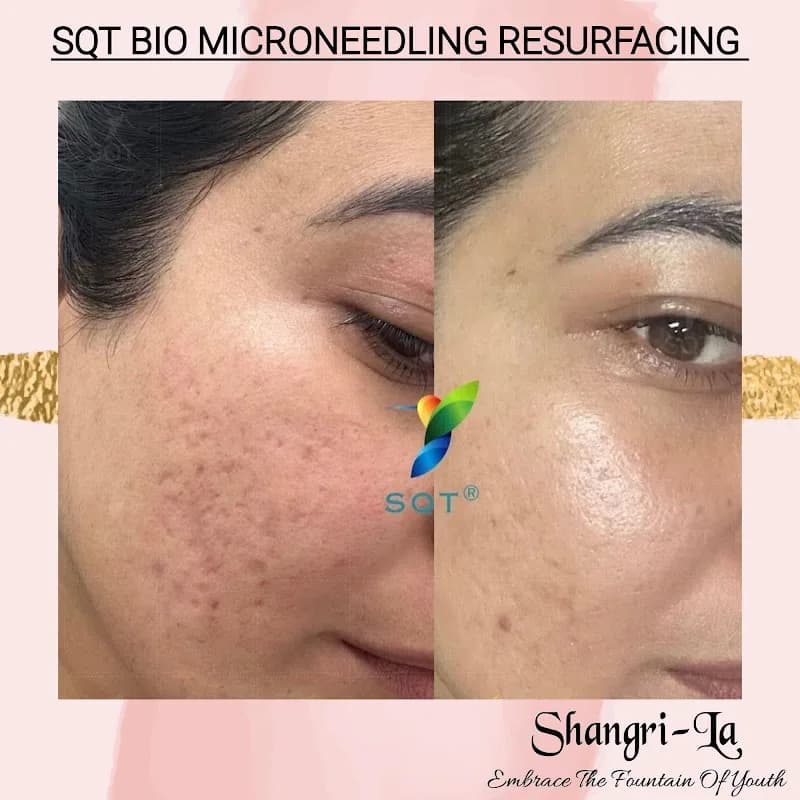 Shangri-La Skin - Beauty - Makeup in Morningside