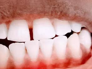 Deoduce Dental Clinic in Agidingbi