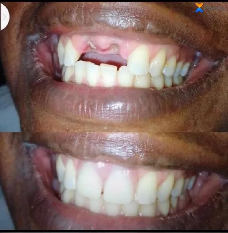 Adebest mobile dental care in Epe