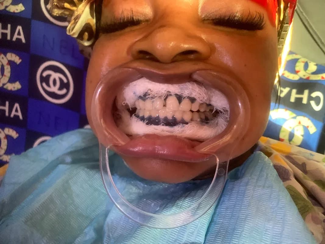 TBerry Dental aesthetics in Ajah