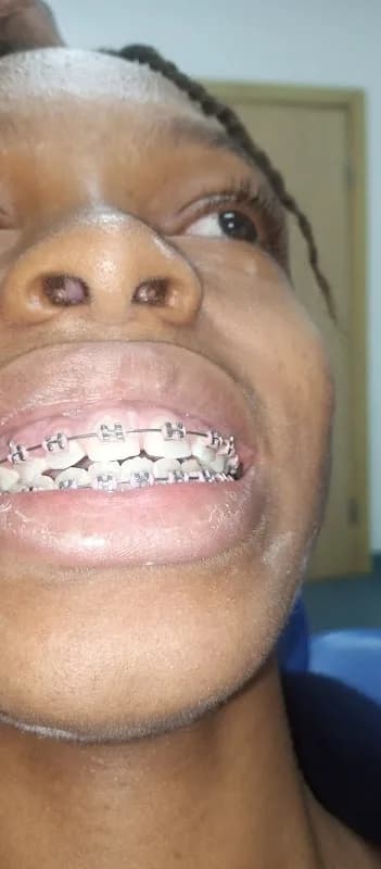 Pema's mobile dental world in Amuwo-Odofin