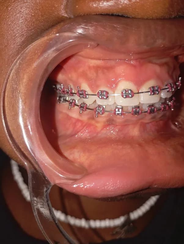 De-Crystal Dental Clinics Lagos - Dental Cleaning, Dental Impant, Dental Brace & Teeth Whitening in Alimosho
