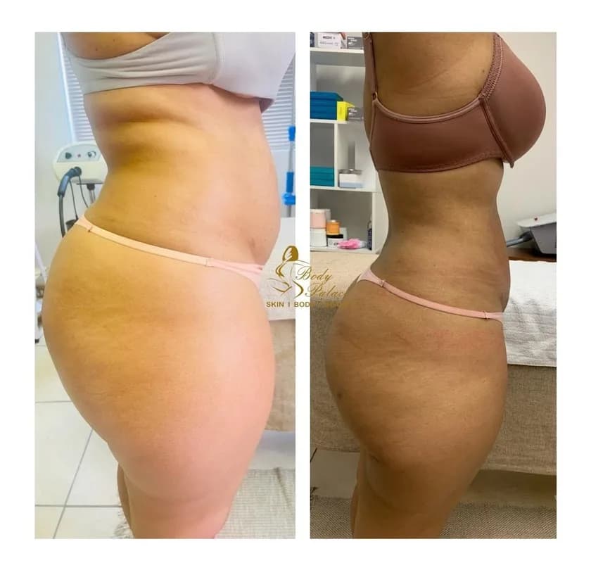 Body Palace Pty Ltd in East Rand Mall