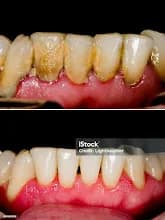 Hillsong dental clinic in Ketu