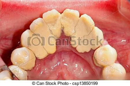 Feel Confident Dental Clinic in Ojo