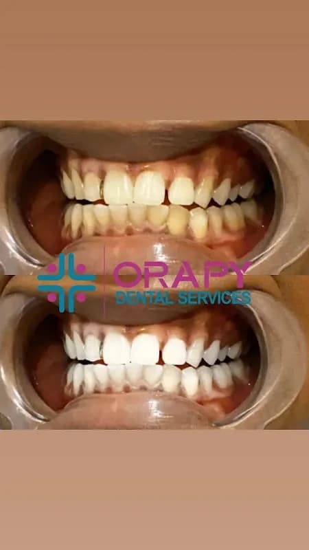 ORAPY DENTAL SERVICES in Isheri