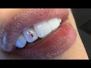Glowbar Aesthetic Clinic in Ikotun