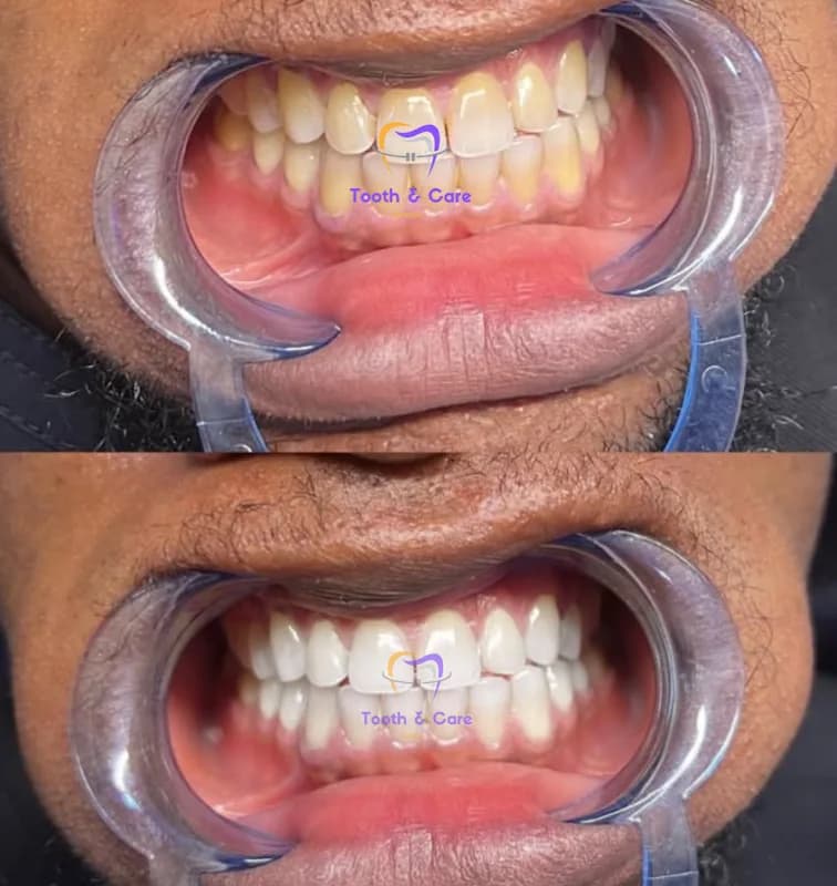 Tooth and Care Dental in Alimosho