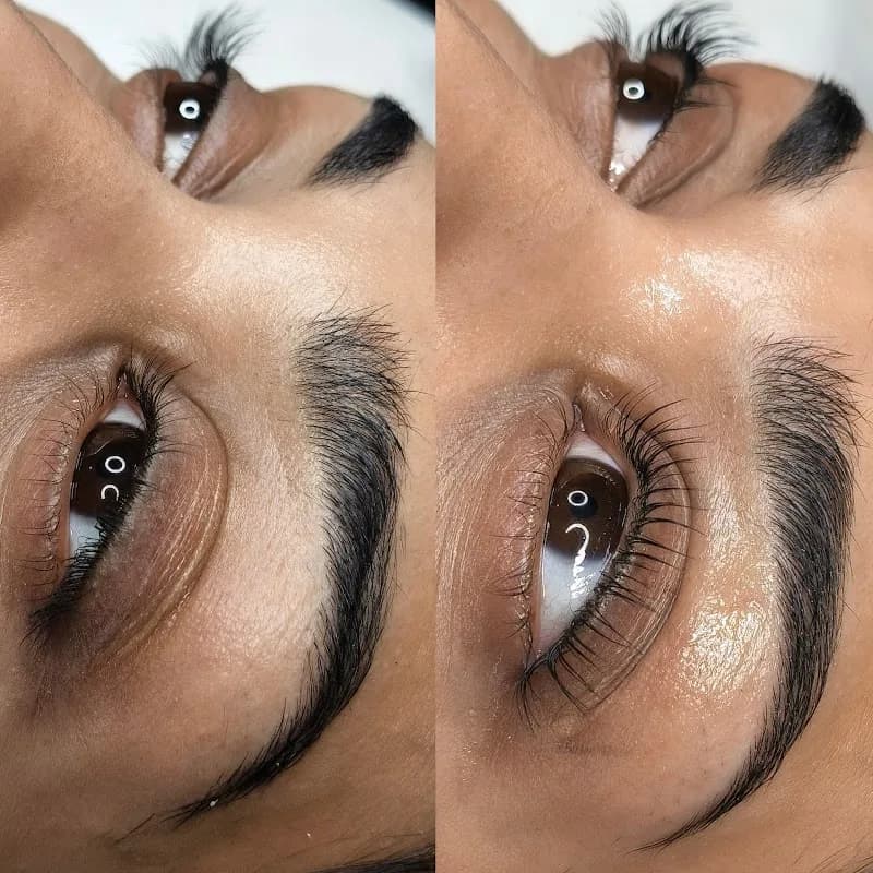 Simplicity Beauty Clinic in Rustenburg CBD