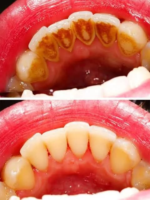 Plutonium Dental Clinic (P.D.C) in Ikorodu